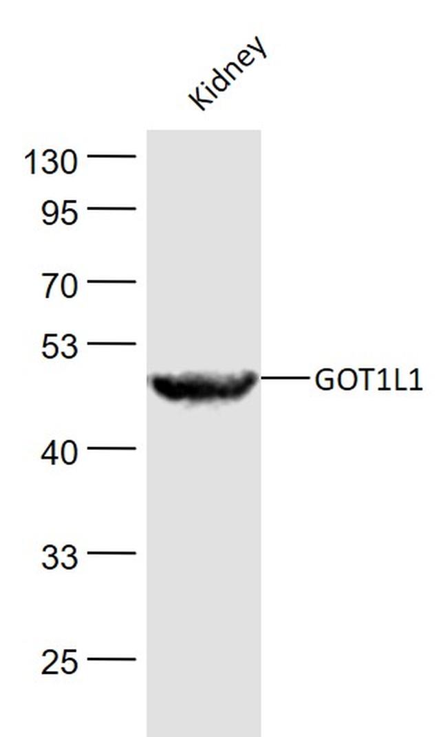 GOT1L1 Antibody in Western Blot (WB)