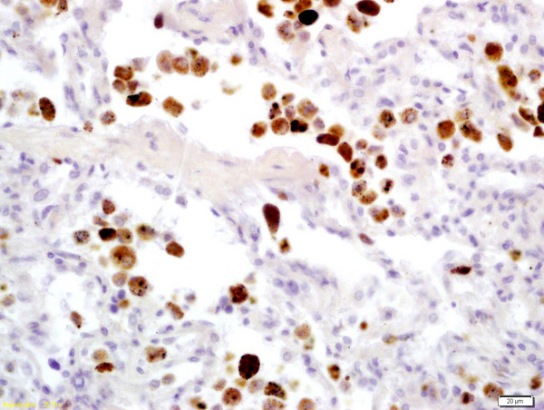 Granzyme B Antibody in Immunohistochemistry (Paraffin) (IHC (P))