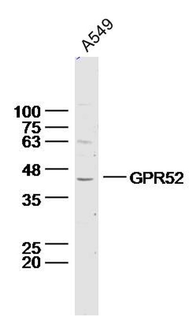 GPR52 Antibody in Western Blot (WB)