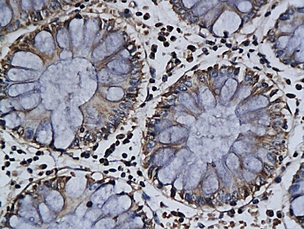 Apolipoprotein J Antibody in Immunohistochemistry (Paraffin) (IHC (P))