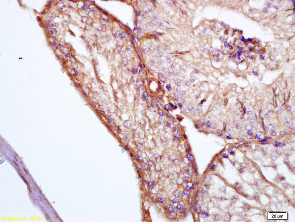 Apolipoprotein J Antibody in Immunohistochemistry (Paraffin) (IHC (P))