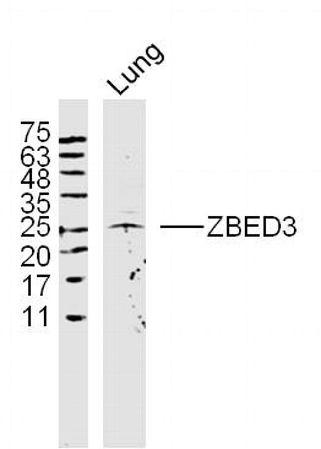 ZBED3 Antibody in Western Blot (WB)