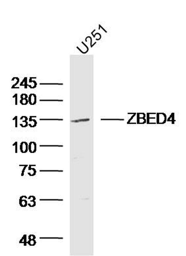 ZBED4 Antibody in Western Blot (WB)