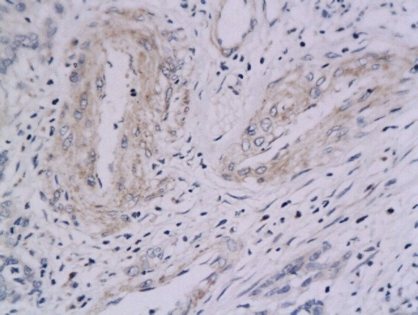 Integrin Alpha V + Beta 5 Antibody in Immunohistochemistry (Paraffin) (IHC (P))