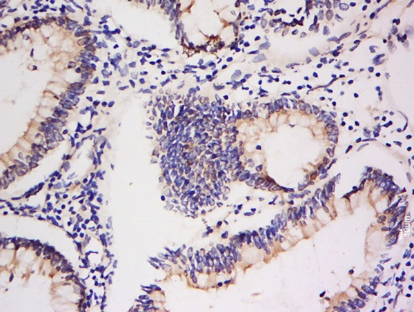 Integrin Alpha V + Beta 5 Antibody in Immunohistochemistry (Paraffin) (IHC (P))