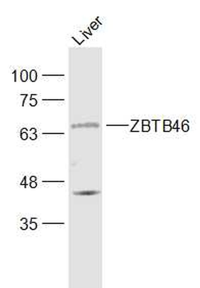 ZBTB46/BTBD4 Antibody in Western Blot (WB)