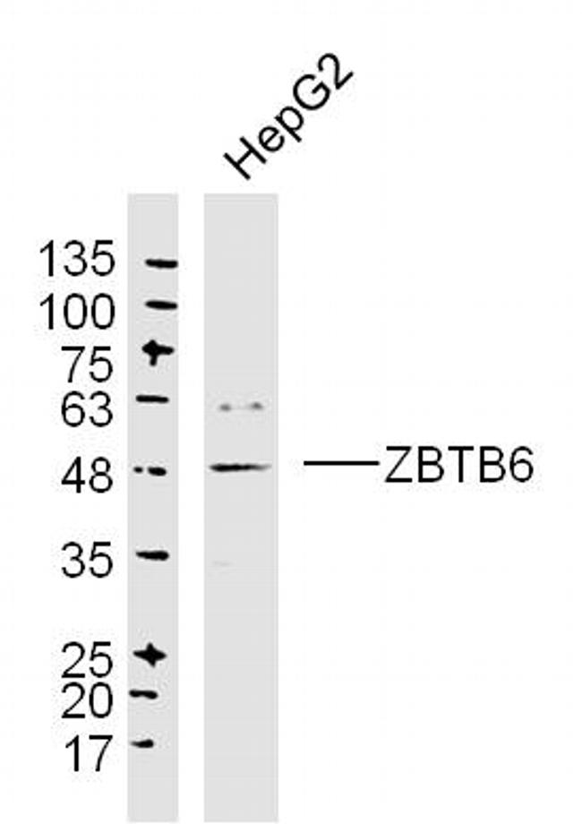 ZBTB6/ZNF482 Antibody in Western Blot (WB)