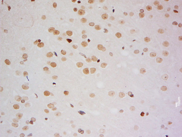 ZMYM2/ZNF198 Antibody in Immunohistochemistry (Paraffin) (IHC (P))