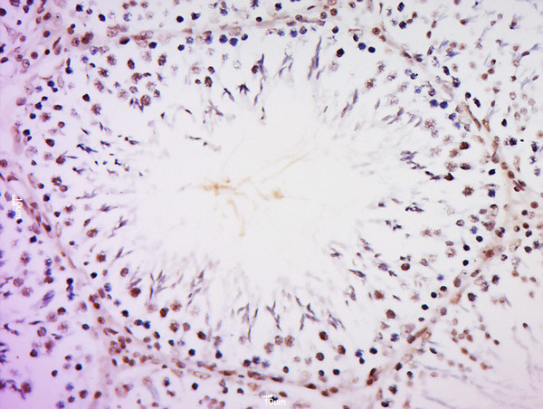 ZMYM2/ZNF198 Antibody in Immunohistochemistry (Paraffin) (IHC (P))