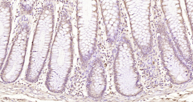 ZMYM2/ZNF198 Antibody in Immunohistochemistry (Paraffin) (IHC (P))