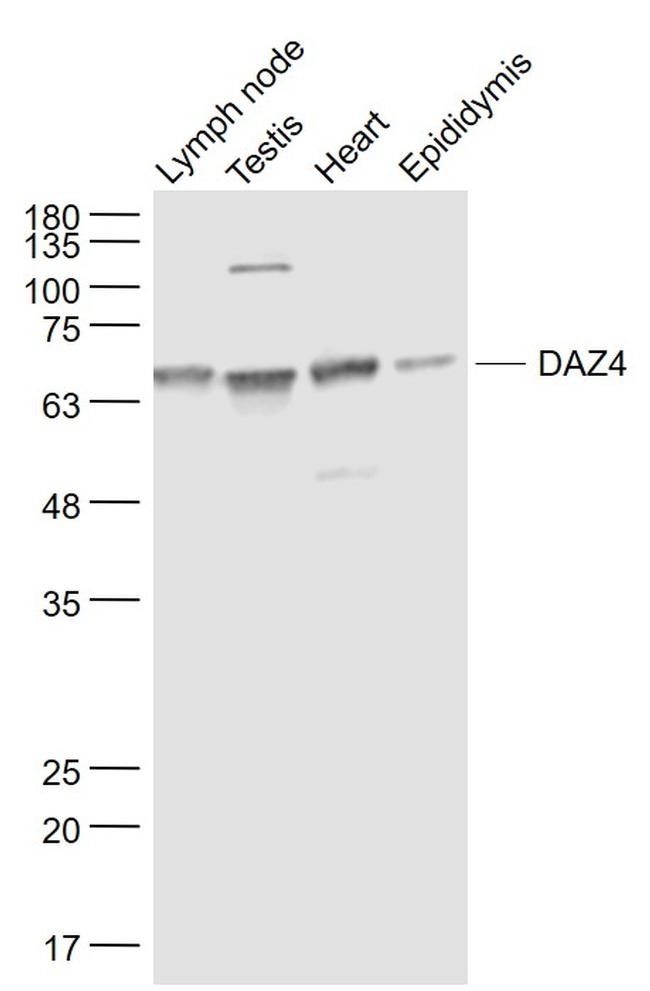 DAZ4 Antibody in Western Blot (WB)
