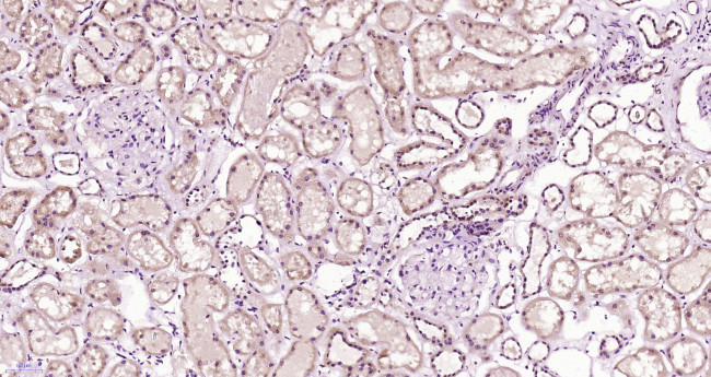 CLEC9A Antibody in Immunohistochemistry (Paraffin) (IHC (P))