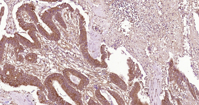 CLEC9A Antibody in Immunohistochemistry (Paraffin) (IHC (P))