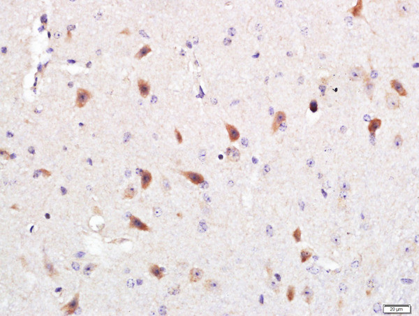 Optineurin Antibody in Immunohistochemistry (Paraffin) (IHC (P))