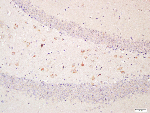 Optineurin Antibody in Immunohistochemistry (Paraffin) (IHC (P))