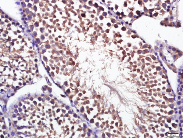 Optineurin Antibody in Immunohistochemistry (Paraffin) (IHC (P))