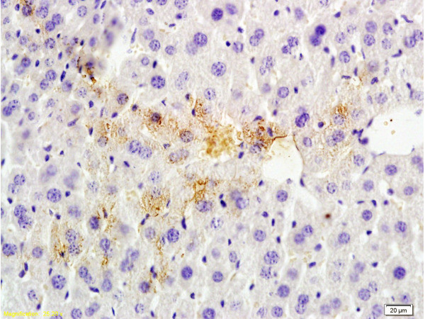 Tsg101 Antibody in Immunohistochemistry (Paraffin) (IHC (P))