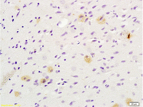 Tsg101 Antibody in Immunohistochemistry (Paraffin) (IHC (P))