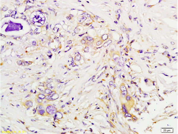 Tsg101 Antibody in Immunohistochemistry (Paraffin) (IHC (P))