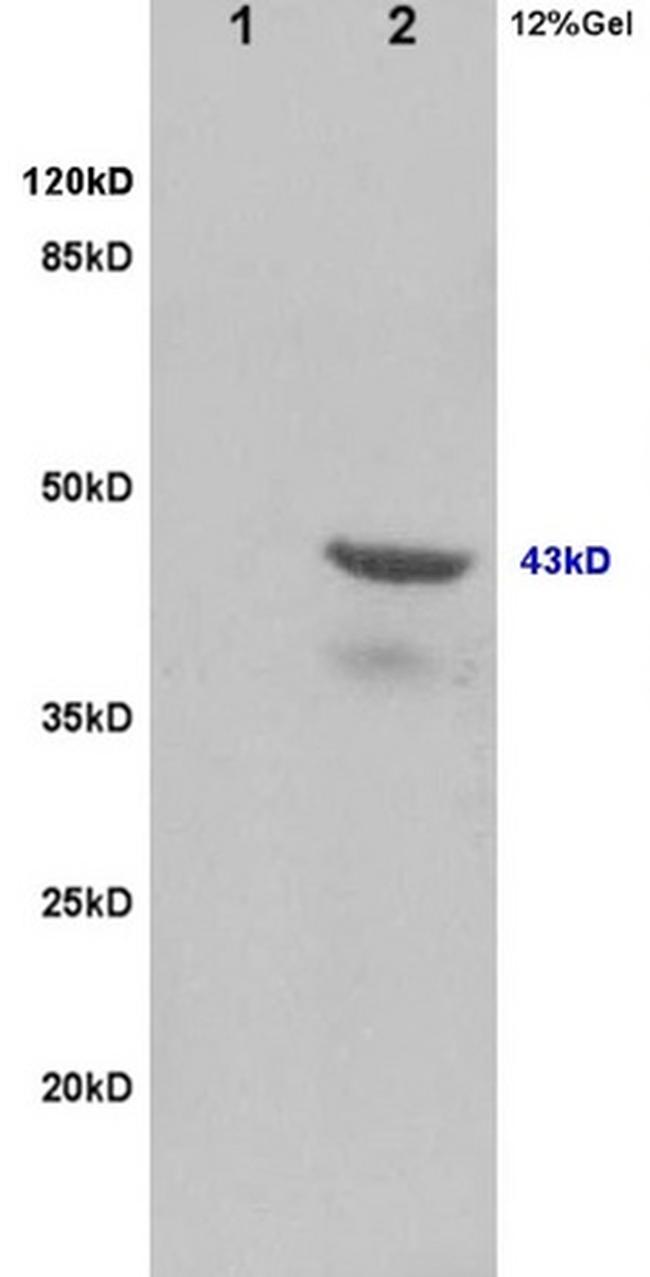 Tsg101 Antibody in Western Blot (WB)