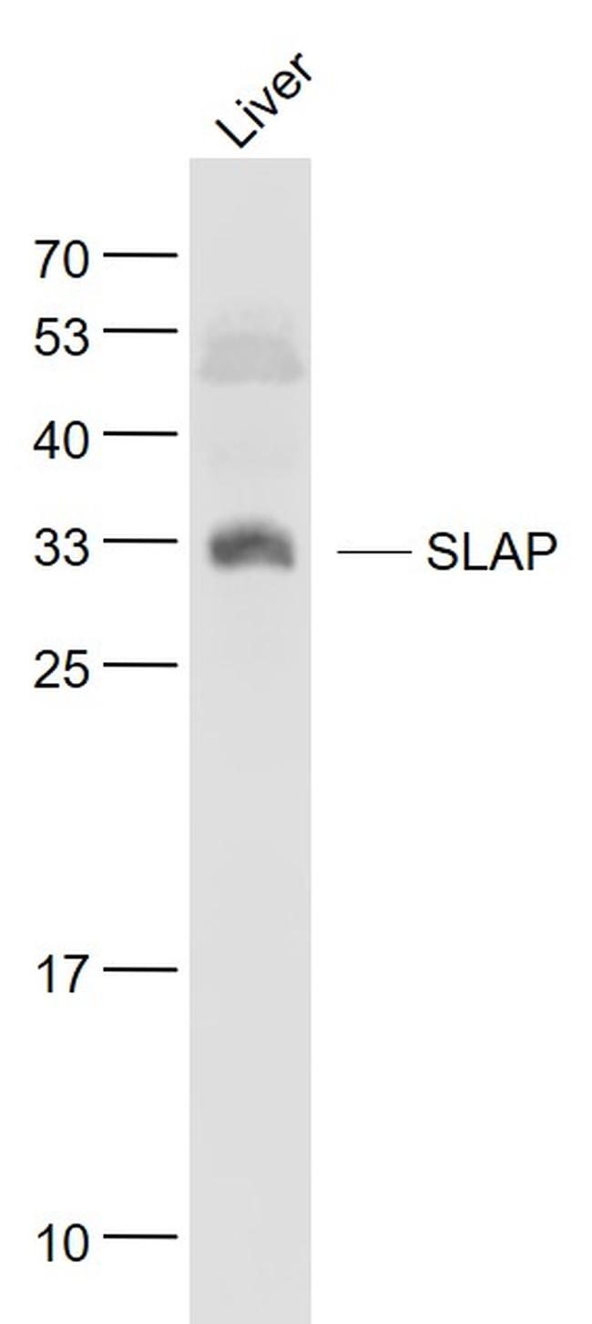 SLAP Antibody in Western Blot (WB)