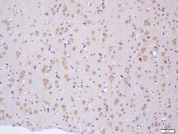 NF2/Neurofibromin 2 Antibody in Immunohistochemistry (Paraffin) (IHC (P))