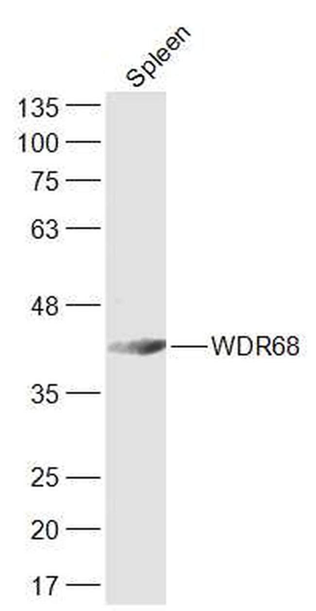 WDR68 Antibody in Western Blot (WB)