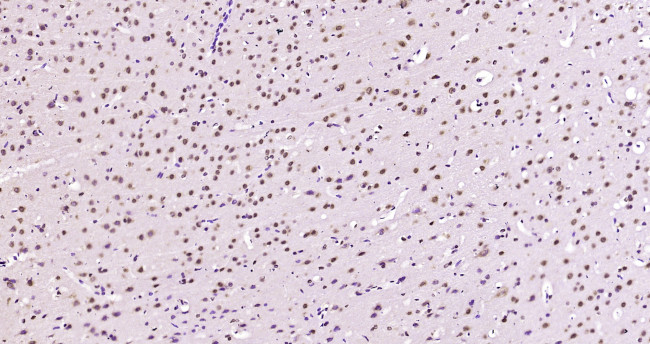 SAM68 Antibody in Immunohistochemistry (Paraffin) (IHC (P))