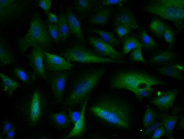 ATM Antibody in Immunocytochemistry (ICC/IF)