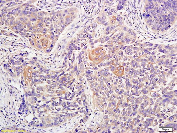 ATM Antibody in Immunohistochemistry (Paraffin) (IHC (P))