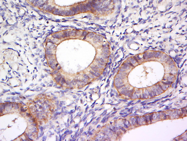 PLEKHA7 Antibody in Immunohistochemistry (Paraffin) (IHC (P))