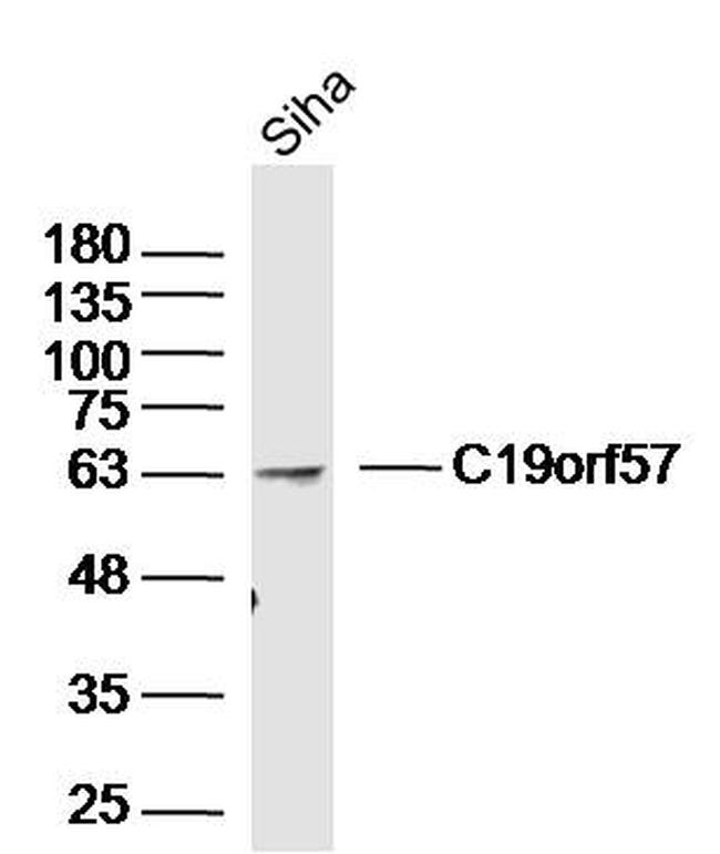C19orf57 Antibody in Western Blot (WB)