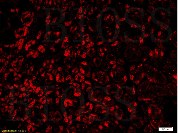 GPR30 Antibody in Immunohistochemistry (Paraffin) (IHC (P))