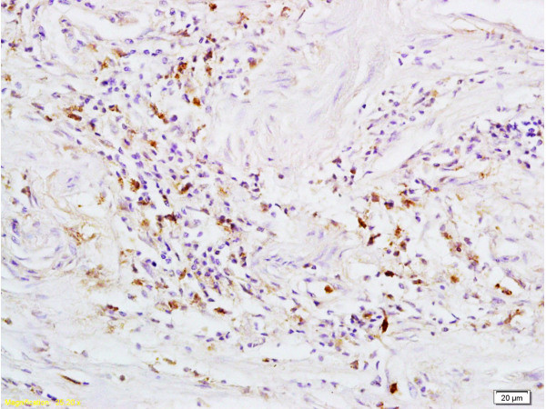 GPR30 Antibody in Immunohistochemistry (Paraffin) (IHC (P))