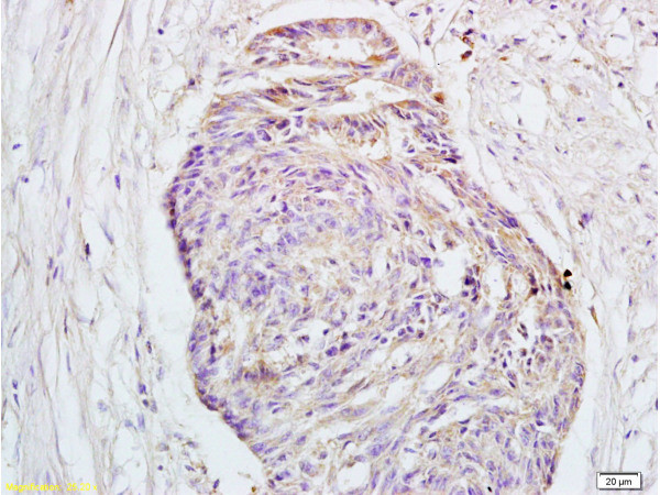 GPR30 Antibody in Immunohistochemistry (Paraffin) (IHC (P))