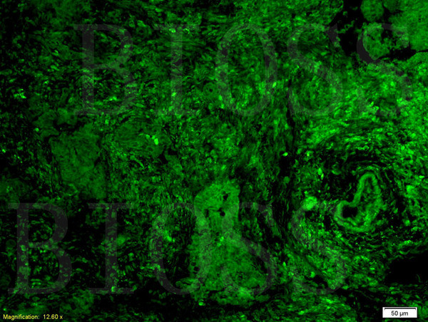 GPR30 Antibody in Immunohistochemistry (Paraffin) (IHC (P))