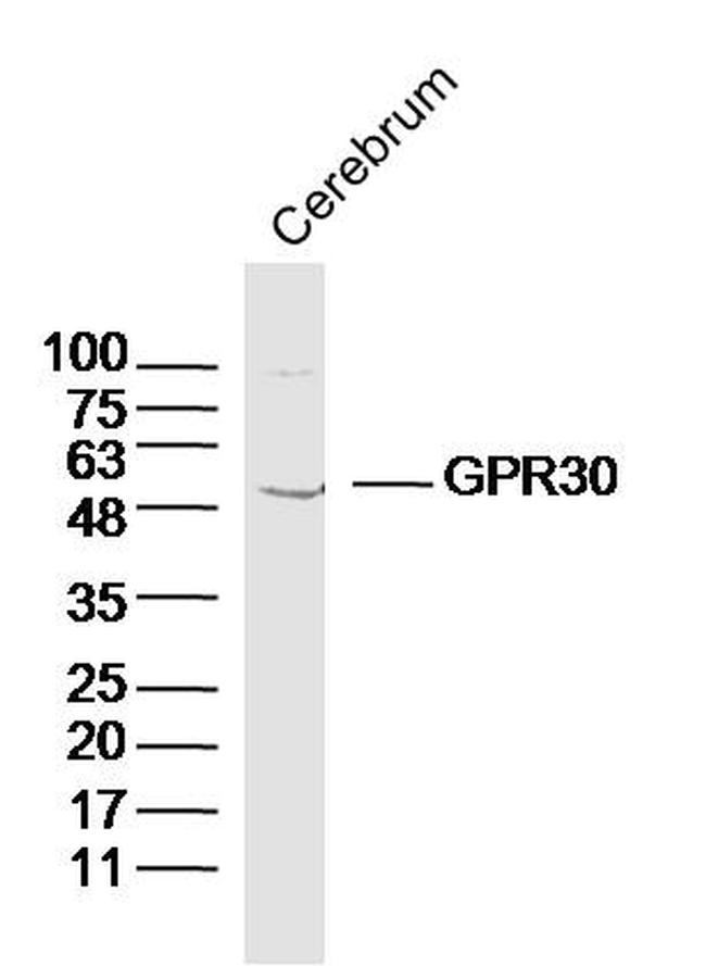 GPR30 Antibody in Western Blot (WB)