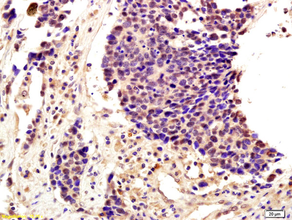 SLUG Antibody in Immunohistochemistry (Paraffin) (IHC (P))