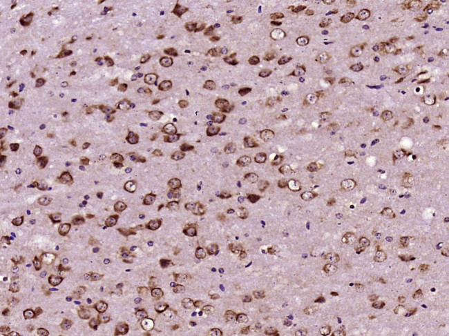 CEP290 Antibody in Immunohistochemistry (Paraffin) (IHC (P))