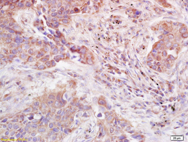 ADAMTS12 Antibody in Immunohistochemistry (Paraffin) (IHC (P))