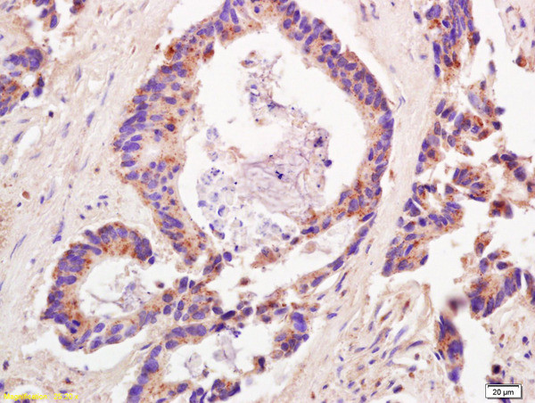 ADAMTS12 Antibody in Immunohistochemistry (Paraffin) (IHC (P))