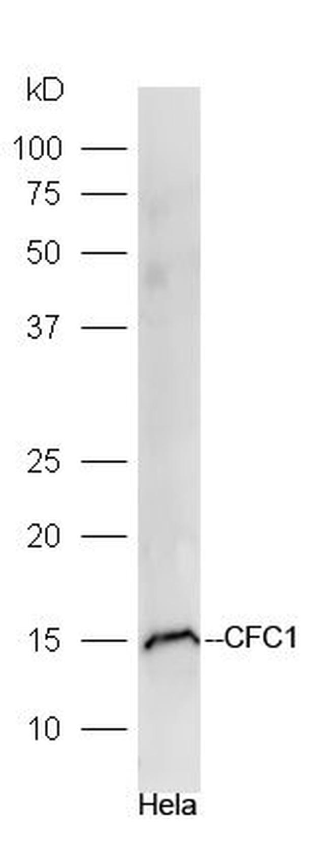 CFC1 Antibody in Western Blot (WB)