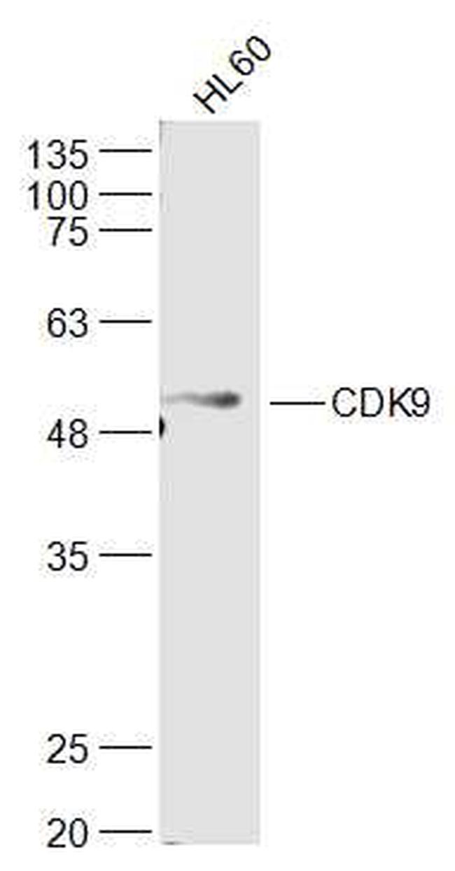 CDK9 Antibody in Western Blot (WB)