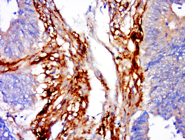 CHPF Antibody in Immunohistochemistry (Paraffin) (IHC (P))