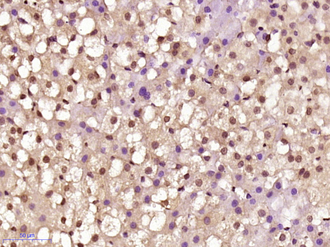 Jun D Antibody in Immunohistochemistry (Paraffin) (IHC (P))