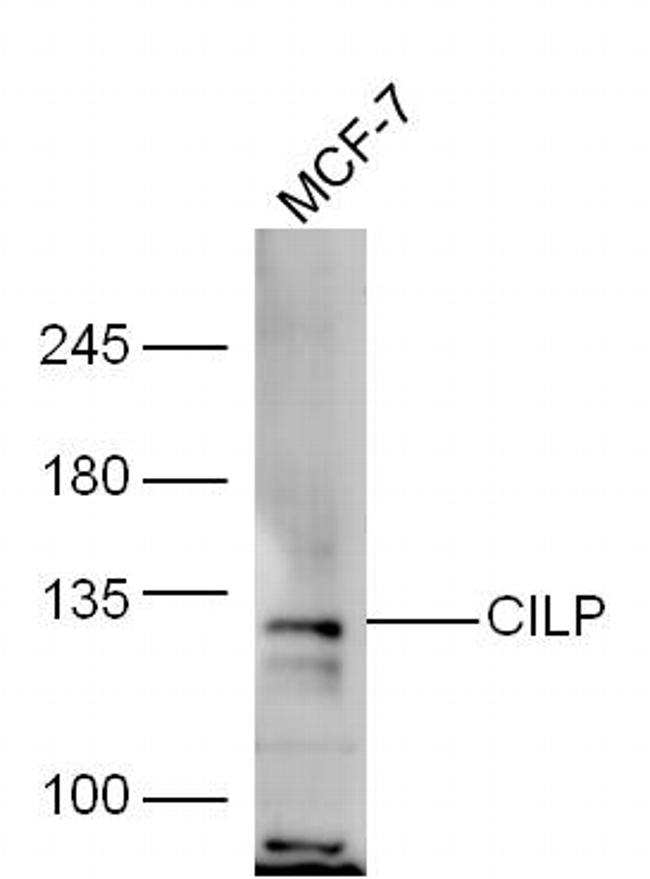 CILP Antibody in Western Blot (WB)