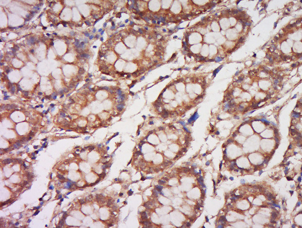 COQ6 Antibody in Immunohistochemistry (Paraffin) (IHC (P))