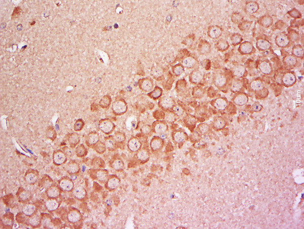 COQ6 Antibody in Immunohistochemistry (Paraffin) (IHC (P))