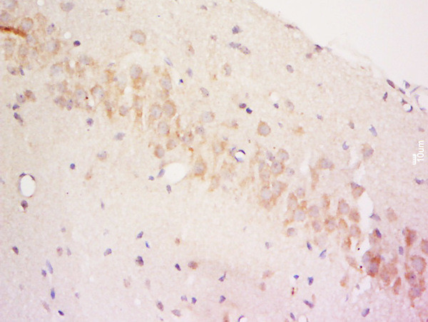 COQ6 Antibody in Immunohistochemistry (Paraffin) (IHC (P))