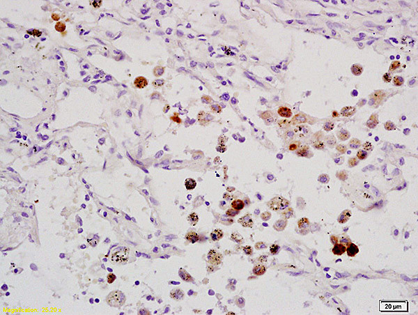 ELK1 Antibody in Immunohistochemistry (Paraffin) (IHC (P))